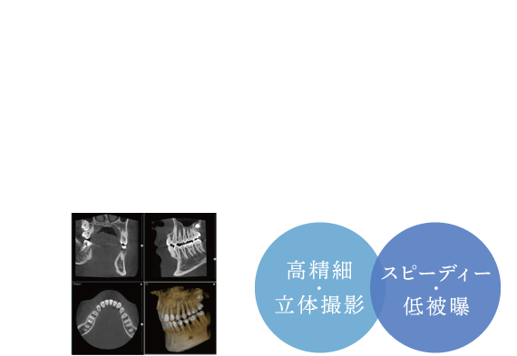 痛みが無い、歯を傷めない