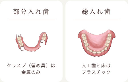 保険診療の入れ歯