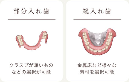 自由診療の入れ歯